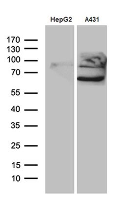 PCSK9 Monoclonal Antibody (OTI8C12), TrueMAB , OriGene 100 &mu;L; Unconjugated:Antibodies,