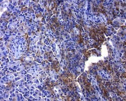 PD-L1 Rabbit anti-Human, liquid, TrueRAB 30 &mu;L; Unconjugated:Antibodies,