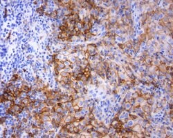 PD-L1 Rabbit anti-Human, liquid, TrueRAB 30 &mu;L; Unconjugated:Antibodies,