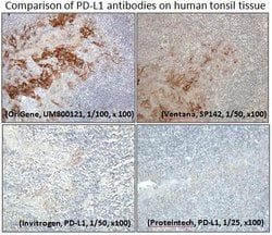 PD-L1 Mouse anti-Human, Clone: UMAB229, liquid, UltraMAB 30 &mu;L; Unconjugated:Antibodies,