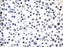 PD-L1 Mouse anti-Human, Clone: UMAB229, liquid, UltraMAB 30 &mu;L; Unconjugated:Antibodies,