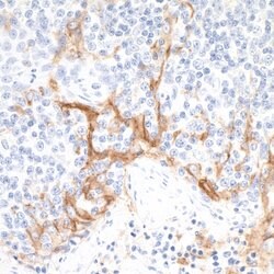 PD-L1 Recombinant Rabbit Monoclonal Antibody (BLR020E), Bethyl Laboratories