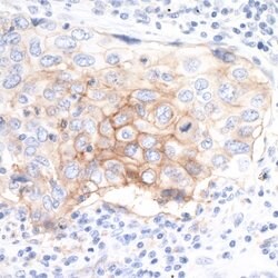 PD-L1 Recombinant Rabbit Monoclonal Antibody (BLR020E), Bethyl Laboratories