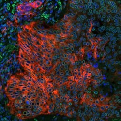 PD-L1 Recombinant Rabbit Monoclonal Antibody (BLR020E), Bethyl Laboratories
