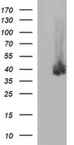 PD-L1 Monoclonal Antibody (OTI1B12), TrueMAB , OriGene 100 &mu;L; Unconjugated:Antibodies,