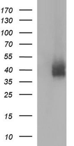 PD-L1 Mouse anti-Human, Clone: OTI2E3, lyophilized, TrueMAB 100 &mu;g;