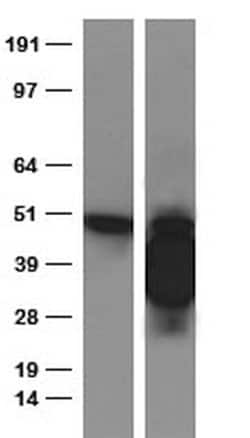 PD-L1 Rabbit anti-Human, liquid, TrueRAB 30 &mu;L; Unconjugated:Antibodies,