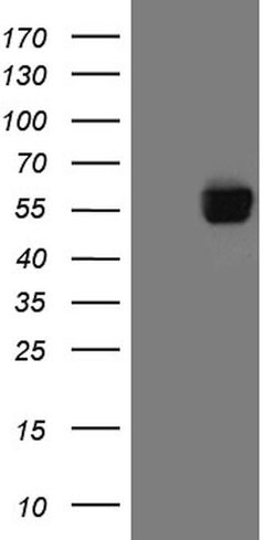 PD-L1 Mouse anti-Human, Clone: OTI12G7, lyophilized, TrueMAB 100 &mu;g;