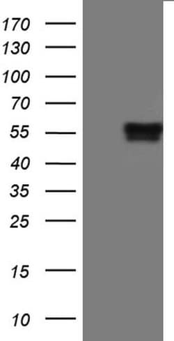 PD-L1 Mouse anti-Human, Clone: UMAB229, liquid, UltraMAB 30 &mu;L; Unconjugated:Antibodies,