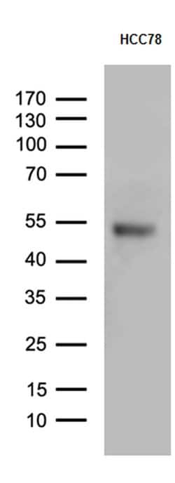 PD-L1 Mouse anti-Human, Clone: UMAB229, liquid, UltraMAB 30 &mu;L; Unconjugated:Antibodies,