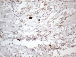 PD-L2 (PDCD1LG2) Monoclonal Antibody (OTI5E5), TrueMAB , OriGene 30 &mu;L | Buy Online | Origene Technologies | Fisher Scientific