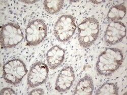 PD-L2 (PDCD1LG2) Monoclonal Antibody (OTI12C7), TrueMAB , OriGene 100 &mu;L;