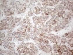 PD-L2 (PDCD1LG2) Monoclonal Antibody (OTI12C7), TrueMAB , OriGene 100 &mu;L;