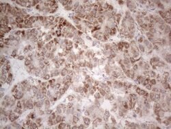 PD-L2 (PDCD1LG2) Monoclonal Antibody (OTI12C7), TrueMAB , OriGene 100 &mu;L;