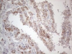PD-L2 (PDCD1LG2) Monoclonal Antibody (OTI6C3), TrueMAB , OriGene:Antibodies:Primary