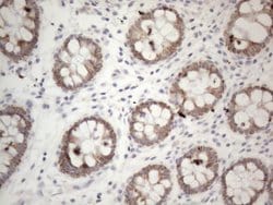 PD-L2 (PDCD1LG2) Monoclonal Antibody (OTI6C3), TrueMAB , OriGene 100 &mu;L;