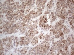 PD-L2 (PDCD1LG2) Monoclonal Antibody (OTI6C3), TrueMAB , OriGene 100 &mu;L;