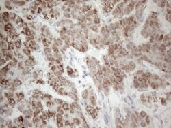 PD-L2 (PDCD1LG2) Monoclonal Antibody (OTI6C3), TrueMAB , OriGene 100 &mu;L;