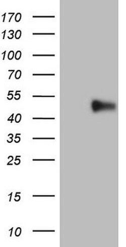 PD-L2 (PDCD1LG2) Mouse anti-Human, Clone: OTI10G2, lyophilized, TrueMAB