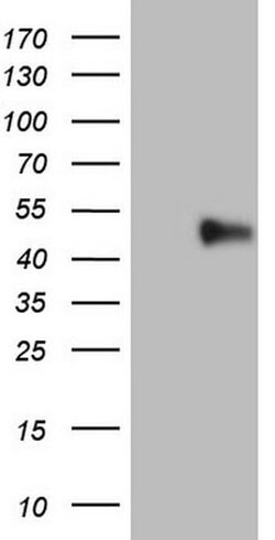 PD-L2 (PDCD1LG2) Monoclonal Antibody (OTI10G2), TrueMAB , OriGene 100 &mu;L;