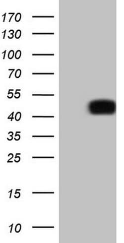 PD-L2 (PDCD1LG2) Monoclonal Antibody (OTI11F9), TrueMAB , OriGene:Antibodies:Primary
