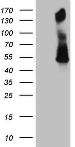 PD-L2 (PDCD1LG2) Monoclonal Antibody (OTI1B5), TrueMAB , OriGene:Antibodies:Primary