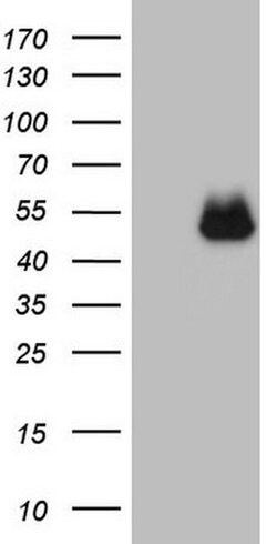PD-L2 (PDCD1LG2) Monoclonal Antibody (OTI7B10), TrueMAB , OriGene 30 &mu;L;