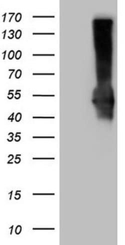 PD-L2 (PDCD1LG2) Monoclonal Antibody (OTI2E7), TrueMAB , OriGene 100 &mu;L;