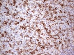 PDCD1 Monoclonal Antibody (OTI4F10), TrueMAB , OriGene 100 &mu;L; Unconjugated:Antibodies,