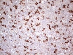 PDCD1 Monoclonal Antibody (OTI11B2), TrueMAB , OriGene 100 &mu;L; Unconjugated:Antibodies,