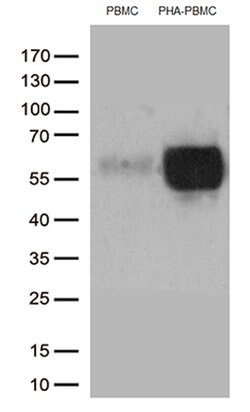 PDCD1 Mouse anti-Human, Clone: OTI3C6, lyophilized, TrueMAB 100 &mu;g;