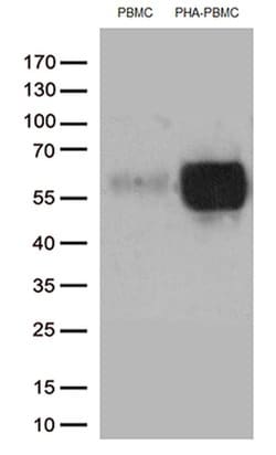 PDCD1 Monoclonal Antibody (OTI3C6), TrueMAB , OriGene 30 &mu;L; Unconjugated:Antibodies,