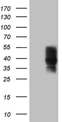 PDCD1 Mouse anti-Human, Clone: OTI8H8, lyophilized, TrueMAB 100 &mu;g;