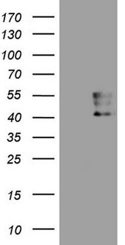 PDCD1 Monoclonal Antibody (OTI8B1), TrueMAB , OriGene 100 &mu;L; Unconjugated:Antibodies,