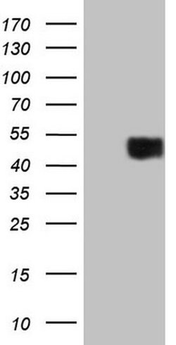 PDCD1 Monoclonal Antibody (OTI6F5), TrueMAB , OriGene 100 &mu;L; Unconjugated:Antibodies,