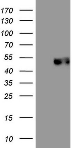 PDCD1 Monoclonal Antibody (OTI17F7), TrueMAB , OriGene 100 &mu;L; Unconjugated:Antibodies,