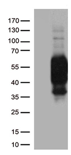 PDCD1 Mouse anti-Canine, Human, Mouse, Rat, Clone: UMAB199, liquid, UltraMAB