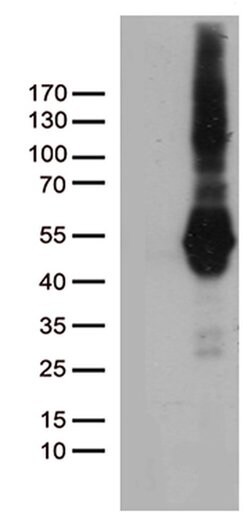 PDCD2L Monoclonal Antibody (OTI4H10), TrueMAB , OriGene 100 &mu;L; Unconjugated:Antibodies,