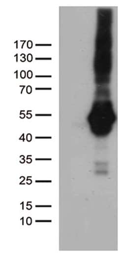 PDCD2L Mouse anti-Human, Clone: OTI4E3, lyophilized, TrueMAB 100 &mu;g;