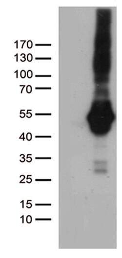 PDCD2L Monoclonal Antibody (OTI4E3), TrueMAB , OriGene 100 &mu;L; Unconjugated:Antibodies,