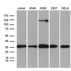 PDCL3 Mouse anti-Human, Clone: OTI6G6, lyophilized, TrueMAB 100 &mu;g;