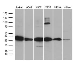 PDCL3 Monoclonal Antibody (OTI10A6), TrueMAB , OriGene 100 &mu;L; Unconjugated:Antibodies,