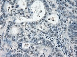 PDE10A Mouse anti-Human, Clone: OTI1C9, lyophilized, TrueMAB 100 &mu;g;