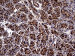 PDE1A Mouse anti-Human, Clone: OTI7D5, lyophilized, TrueMAB 100 &mu;g;