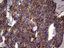 PDE1A Mouse anti-Human, Clone: OTI7D5, lyophilized, TrueMAB 100 &mu;g;