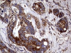PDE1A Mouse anti-Human, Clone: OTI7D5, lyophilized, TrueMAB 100 &mu;g;