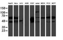 PDE1B Monoclonal Antibody (OTI6B9), TrueMAB , OriGene 30 &mu;L; Unconjugated:Antibodies,