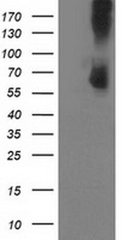 PDE1B Monoclonal Antibody (OTI1D6), TrueMAB , OriGene 100 &mu;L; Unconjugated:Antibodies,