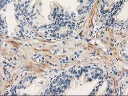 PDE2A Mouse anti-Human, Clone: OTI1G9, lyophilized, TrueMAB 100 &mu;g;