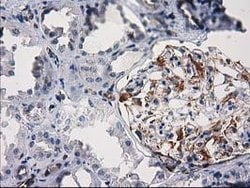 PDE2A Mouse anti-Human, Clone: OTI1G9, lyophilized, TrueMAB 100 &mu;g;